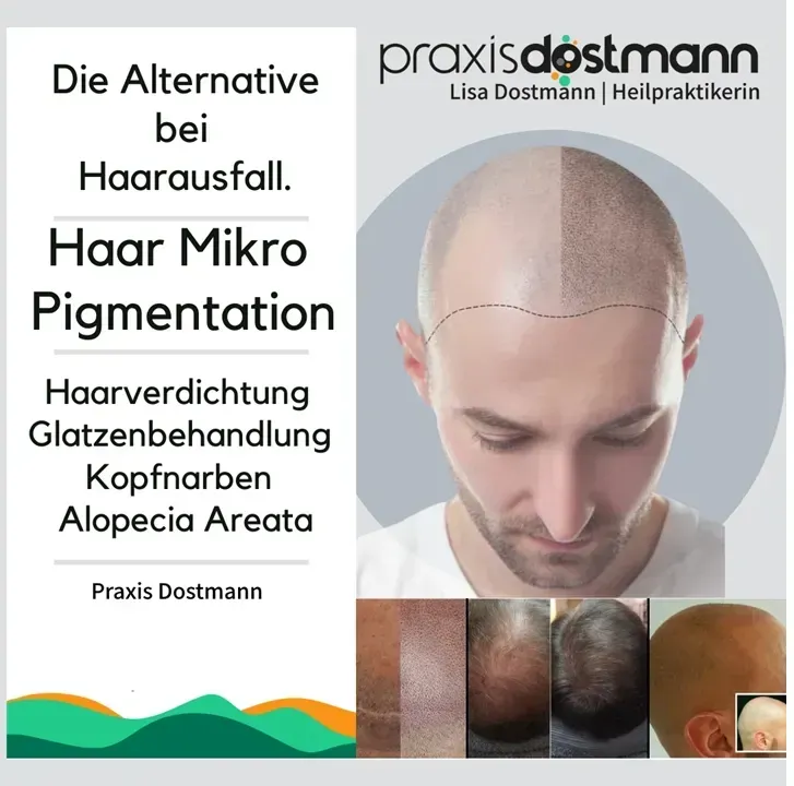 Vorher-Nachher Bilder von haarpigmentierten Glatzen und Halbglatzen